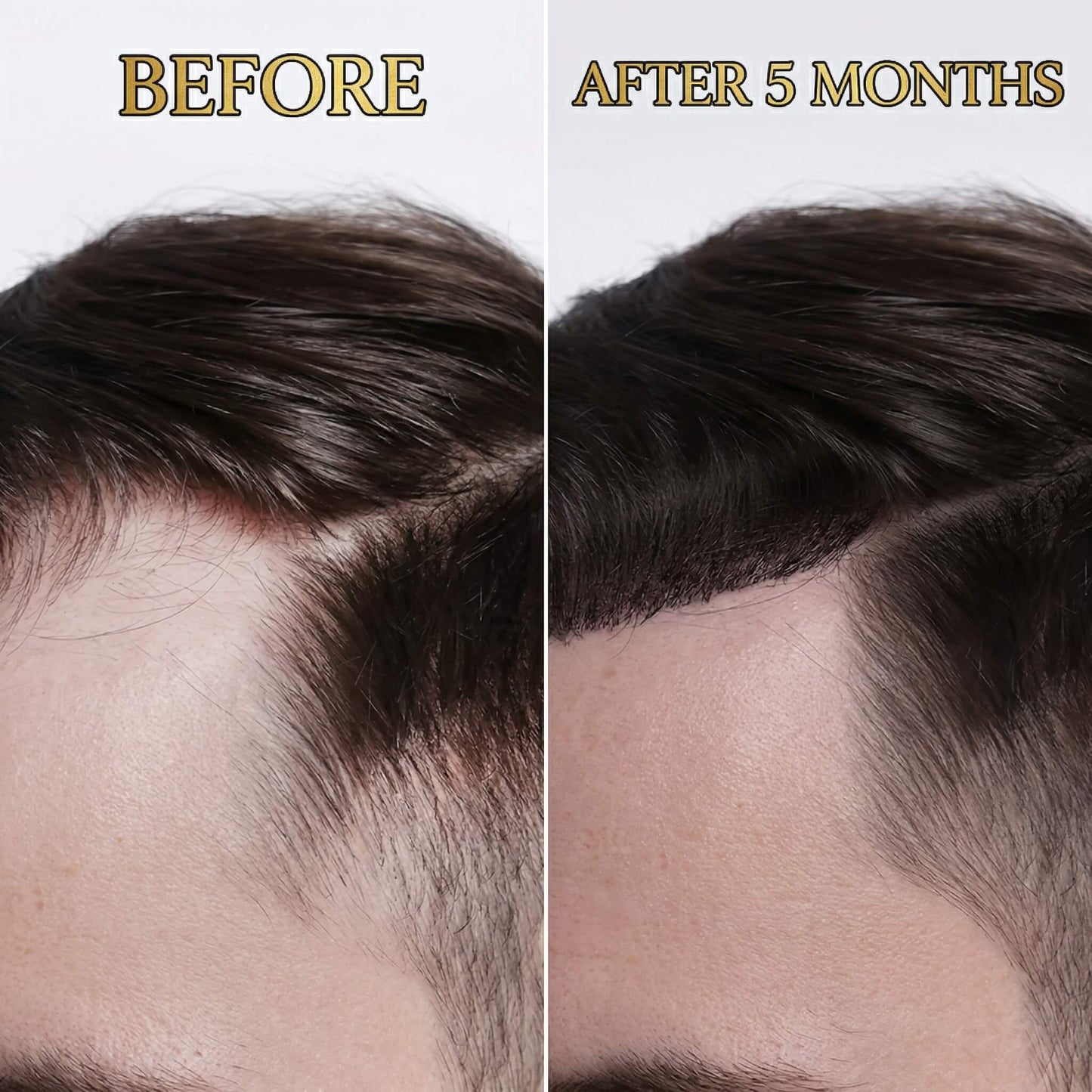 Rediscover the man in the mirror with Mantain Natural Hair Growth Spray